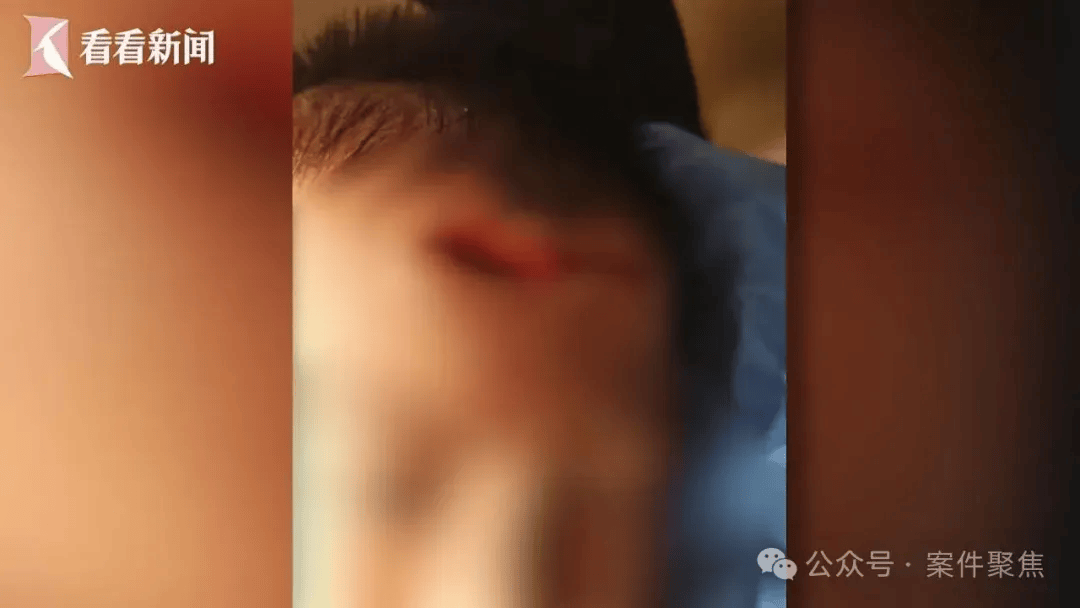 埃及超级联赛_血流不止埃及超级联赛，脸上缝30多针需整容！上海一知名火锅店发生意外，顾客和商家互相指责……